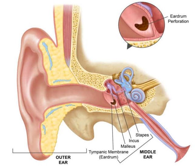 Perforated Eardrum Repair in Lake Jackson, TX